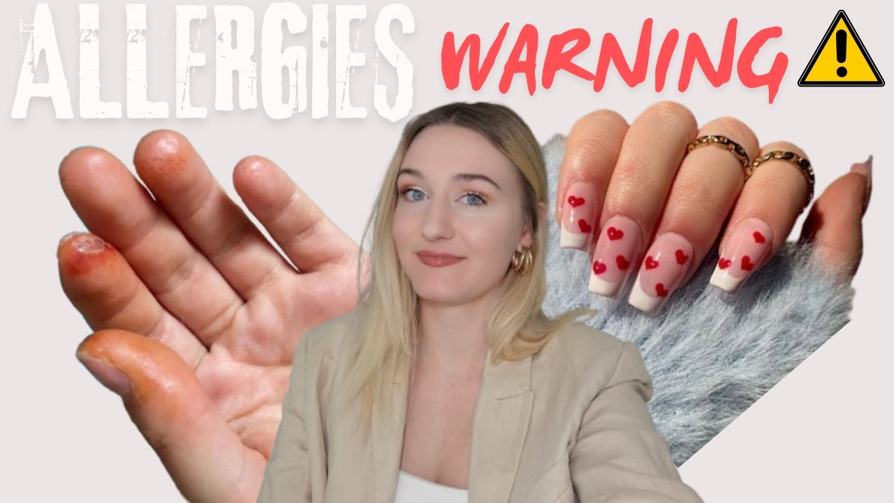 ALLERGIES AUX FAUX ONGLES TOUT SAVOIR : EXPERIENCE, CONSEILS, SOLUTIONS, ALTERNATIVES - LUXIIZ