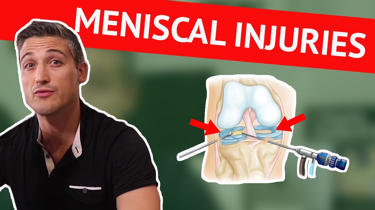 Meniscal Injuries (and why a small decision now could have big ramifications later)