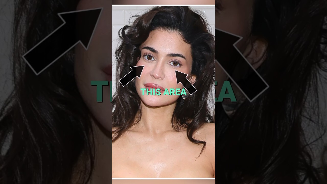 Kylie Jenner's new Fillers | What's the secret? #shorts #kylie