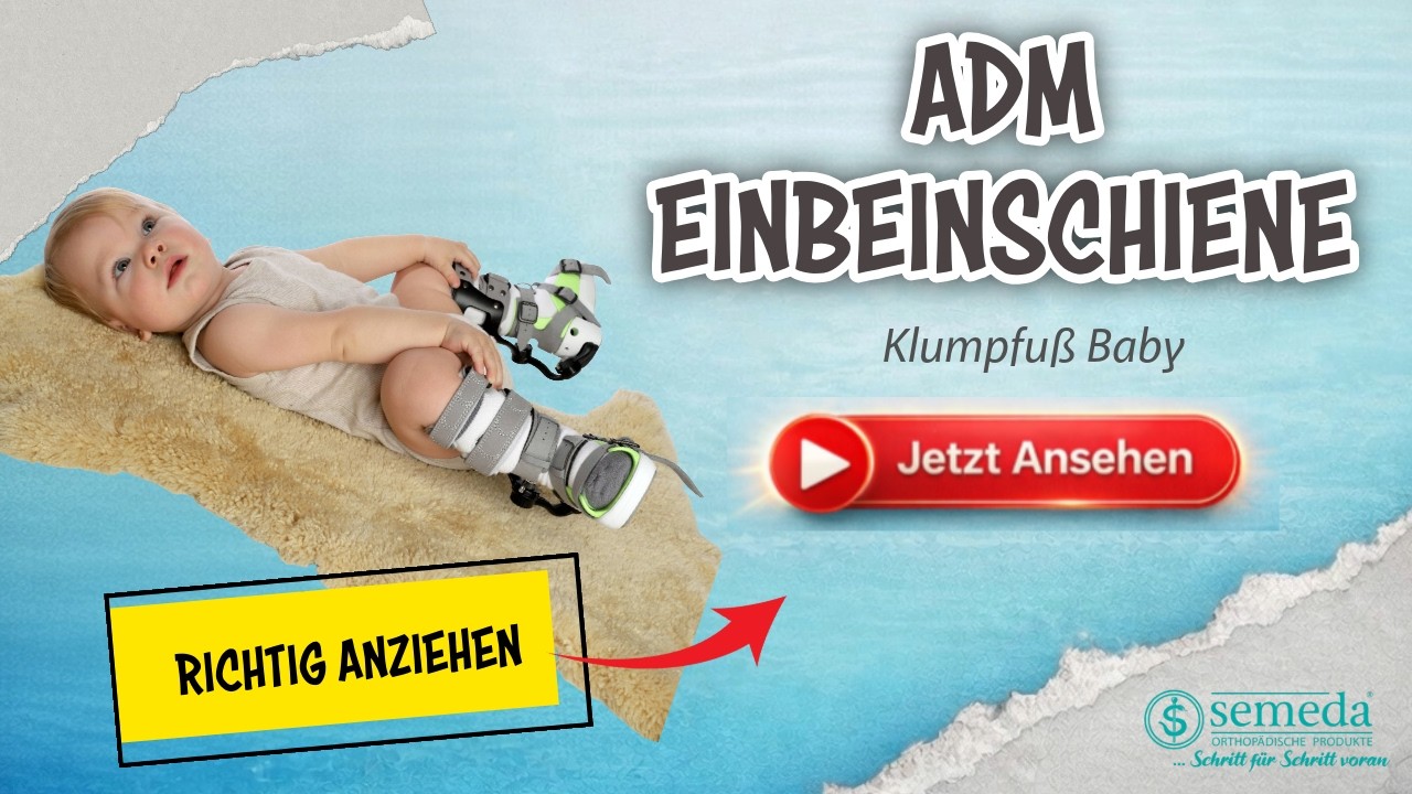 Klumpfuß Behandlung: ADM Einbeinschiene richtig anziehen, Federn korrekt ablesen – Tipps und Tricks