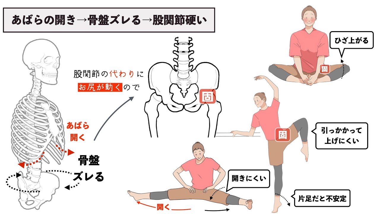 股関節の硬さに左右差が出る意外な原因とセルフ整体