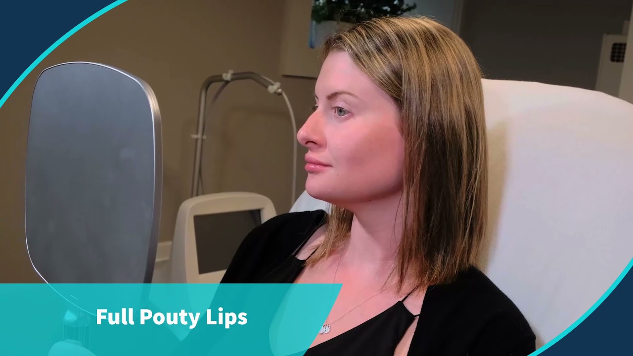 Juv&eacute;derm&trade; Lip Injections