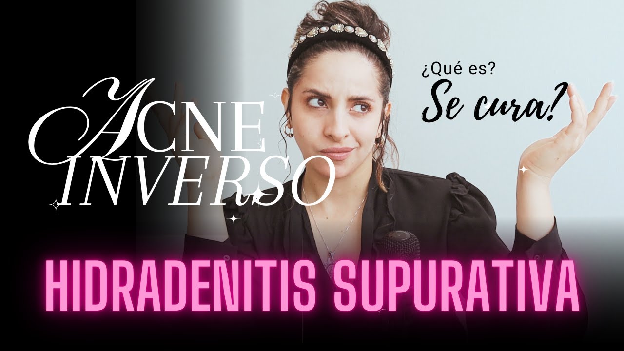 ACNE inverso, Hidradenits Supurativa | ¿Enfermedad desconocida, tiene cura?