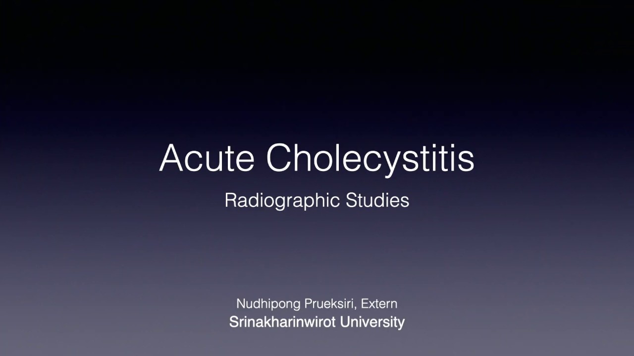 Acute Cholecystitis - Radiographic Studies