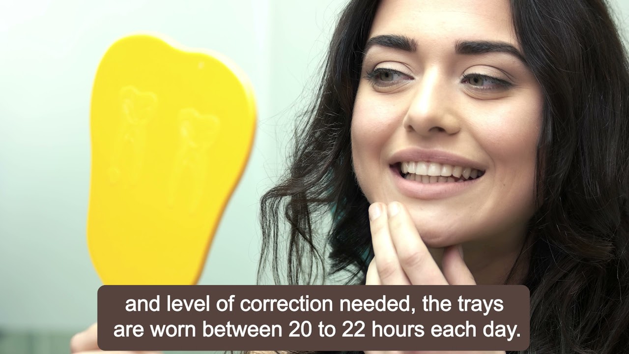 How Does Invisalign Work?