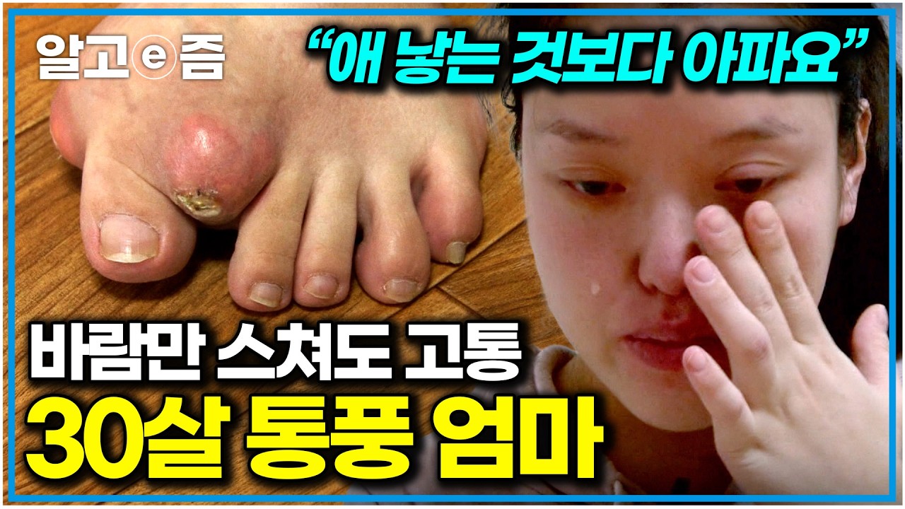 “말로 표현할 수 없는 아픔” 두 아이 키우다 통풍 치료 시기를 놓쳤더니.. 신발조차 신을 수 없게 된 30살 엄마｜EBS 가족건강 프로젝트｜알고e즘