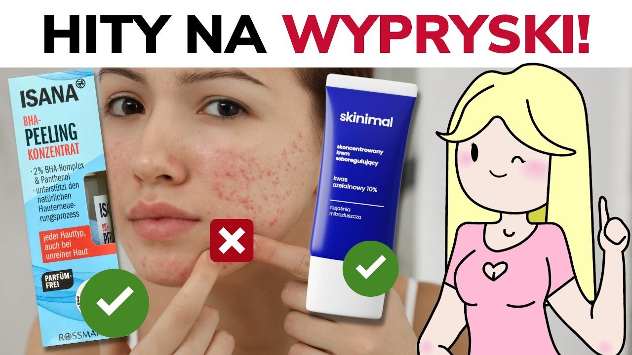 Trądzik, zaskórniki, pryszcze! - Jakie kosmetyki wybrać? | W Krainie Składów