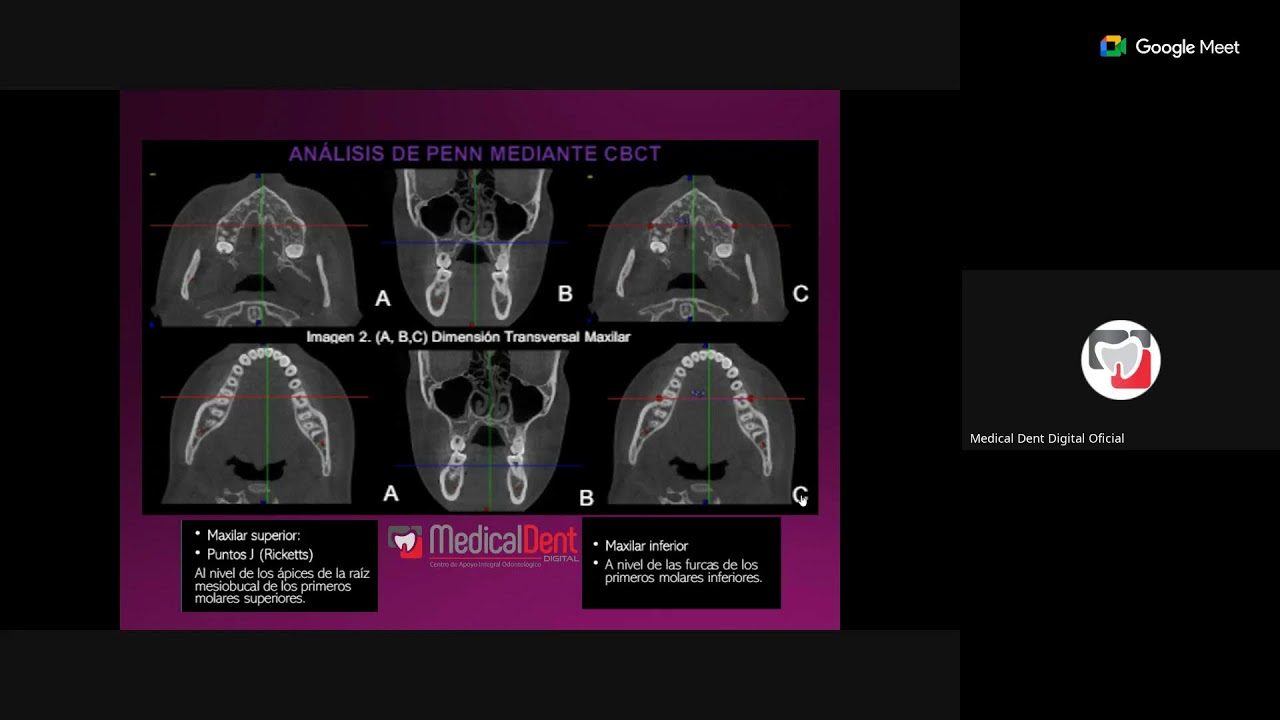 Tomografía Cone Beam para ortodoncia