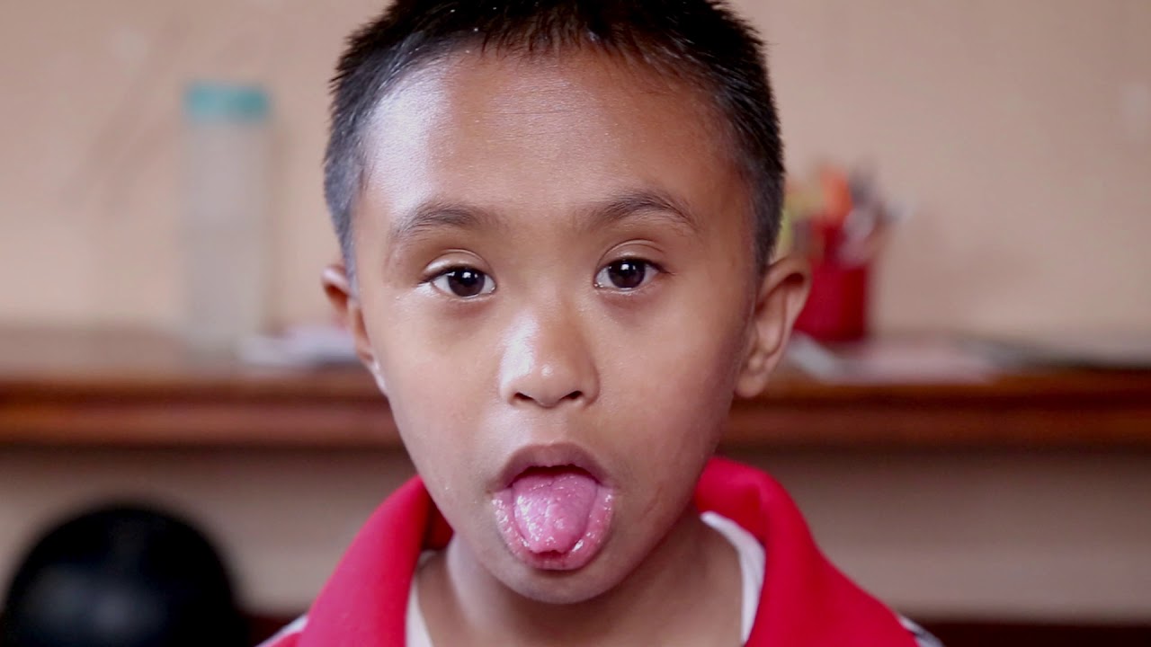 DOWN SYNDROME FINAL