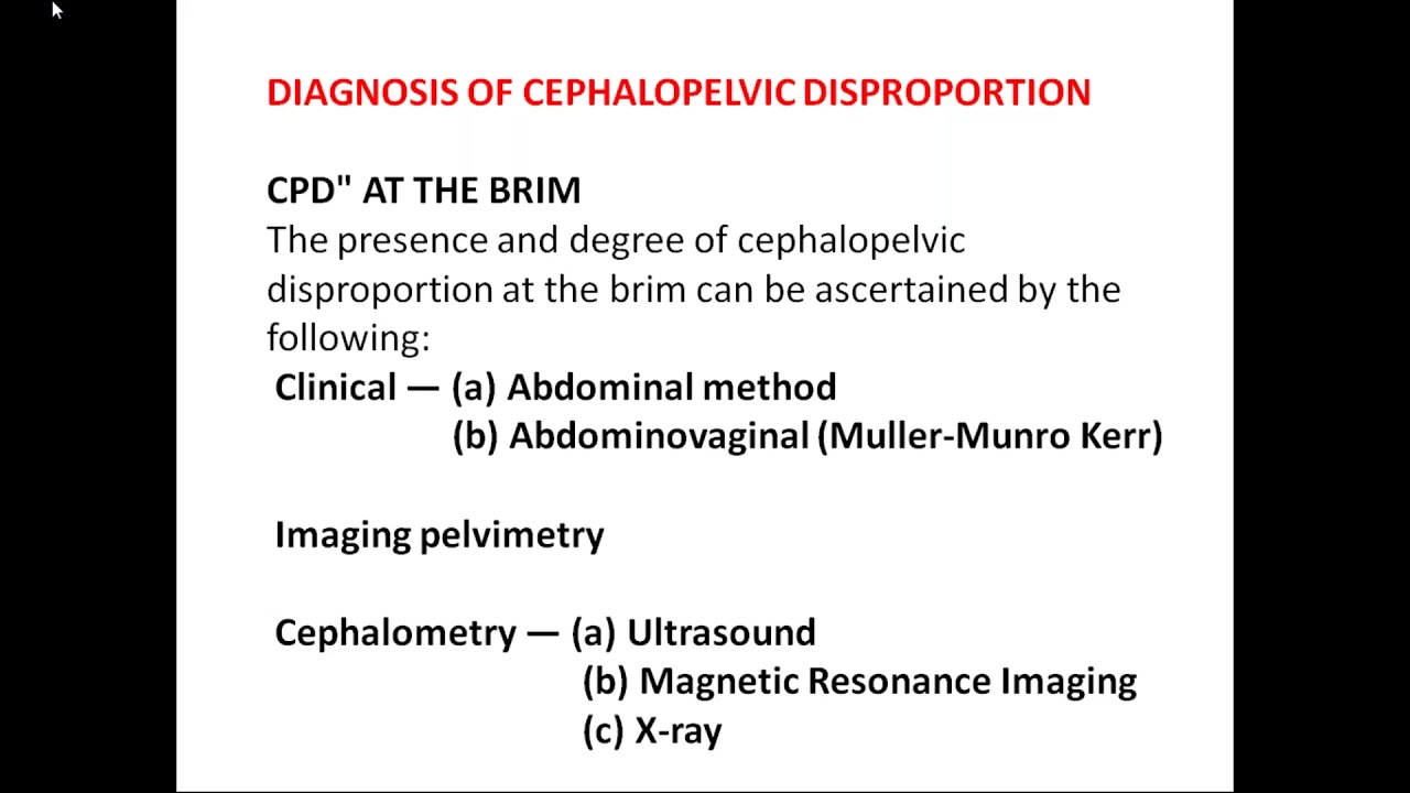 A CLASS ON CEPHALOPELVIC DISPROPORTION (CPD) BY  Dr Sri Lakshmi Asst professor,OBGY.
