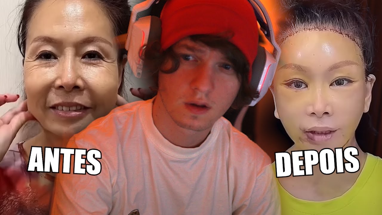 Vendo o cirurgião do TikTok que deforma as pessoas