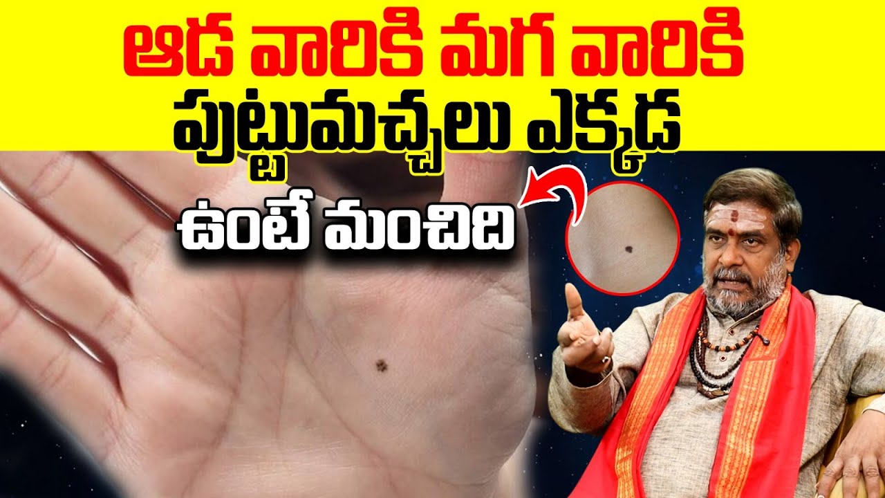 ఆడవారికి, మగవారికి పుట్టుమచ్చలు ఎక్కడ ఉంటే మంచిది? | Lucky Moles for Men & Women