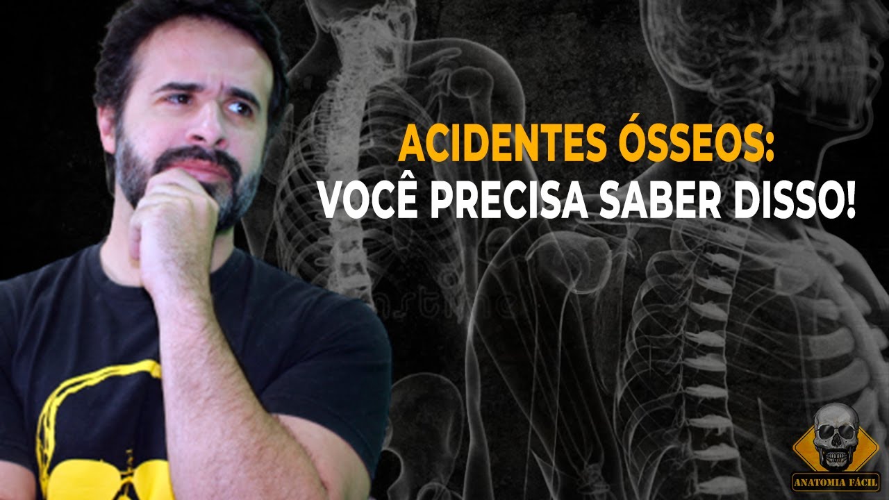 ACIDENTES &Oacute;SSEOS: TUDO QUE VOC&Ecirc; PRECISA SABER!