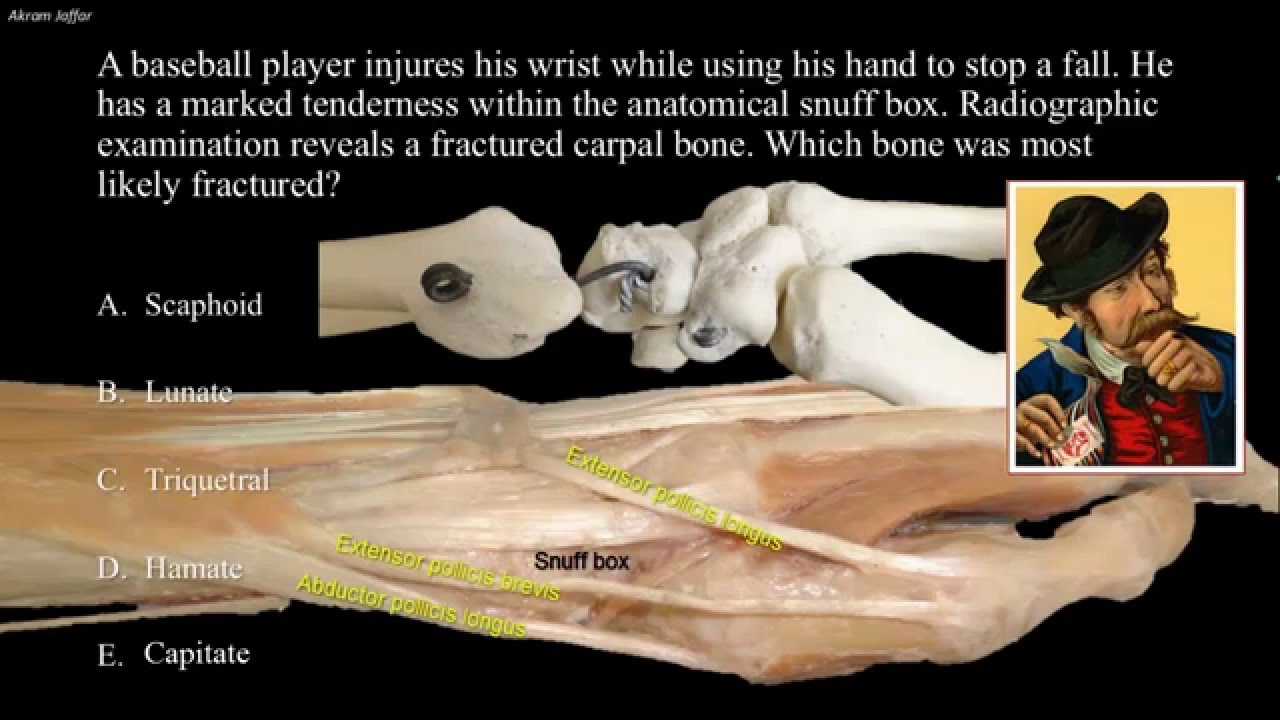 Tenderness at the anatomical snuff box