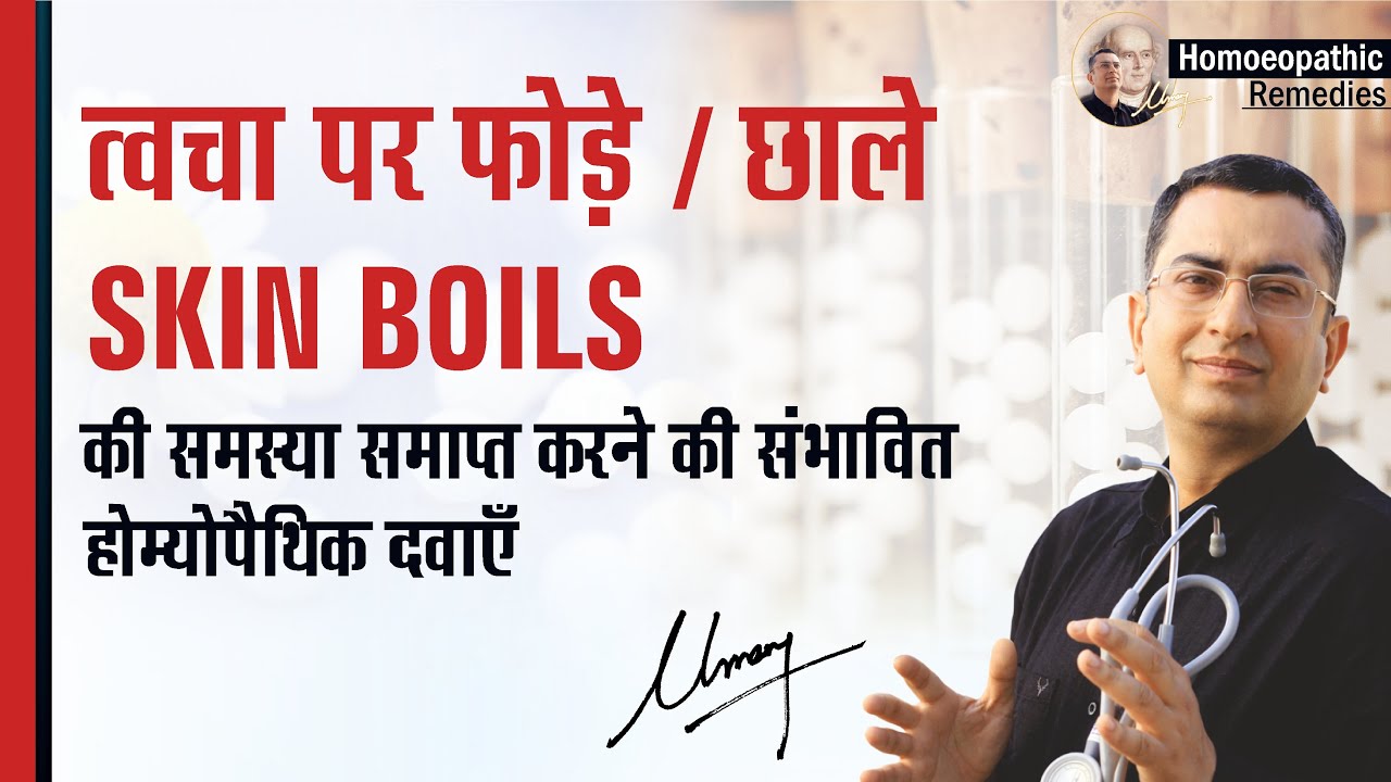 त्वचा में बार बार फोड़े फुंसी निकलना || Boils / Carbuncle || Natural homeopathic remedies symptoms