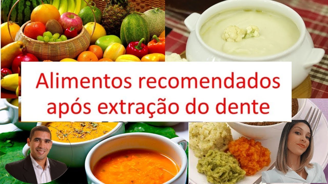 Alimentos recomendados após extração do dente. @Dr. Alex Guedes