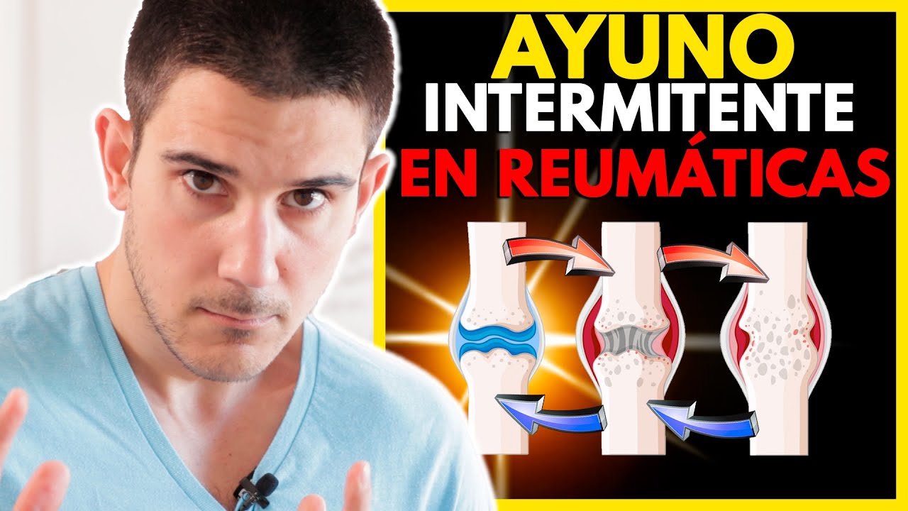 AYUNO INTERMITENTE y Su IMPACTO En Enfermedades REUMÁTICAS 💊🦴*Nuevo Estudio*