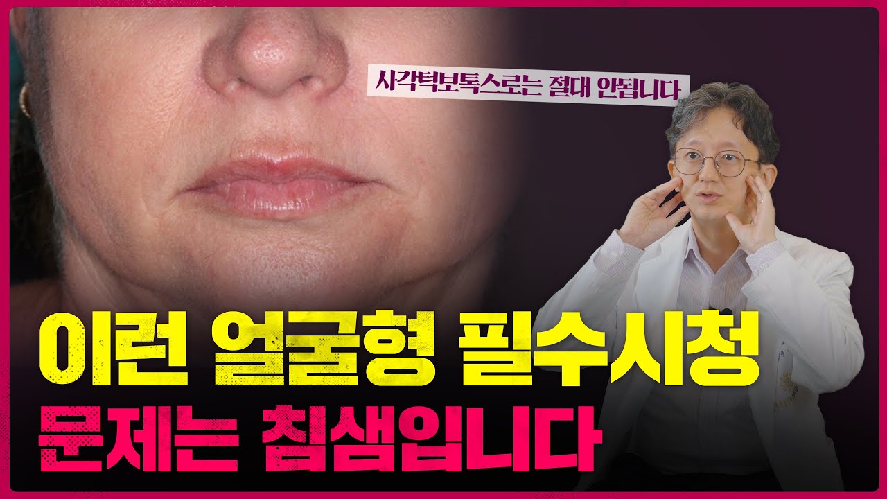 턱보톡스로도 얼굴형에 변화가 없다면? 침샘비대증을 의심해봐야 합니다
