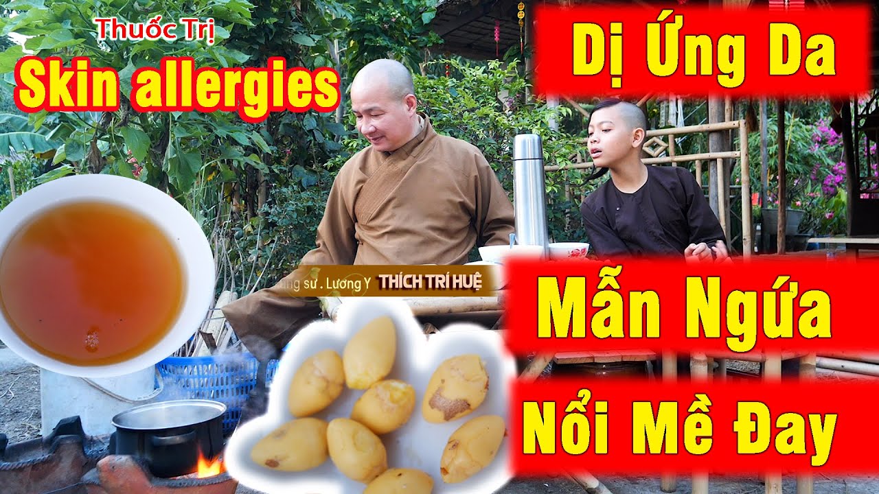 Da Dị Ứng-skin allergies, Mẫn Ngứa, Mề Đay, Phong Ngứa, Mục Nước, Ngứa Ngấy kh&oacute; chịu. Ch&ugrave;a Ph&aacute;p Tạng