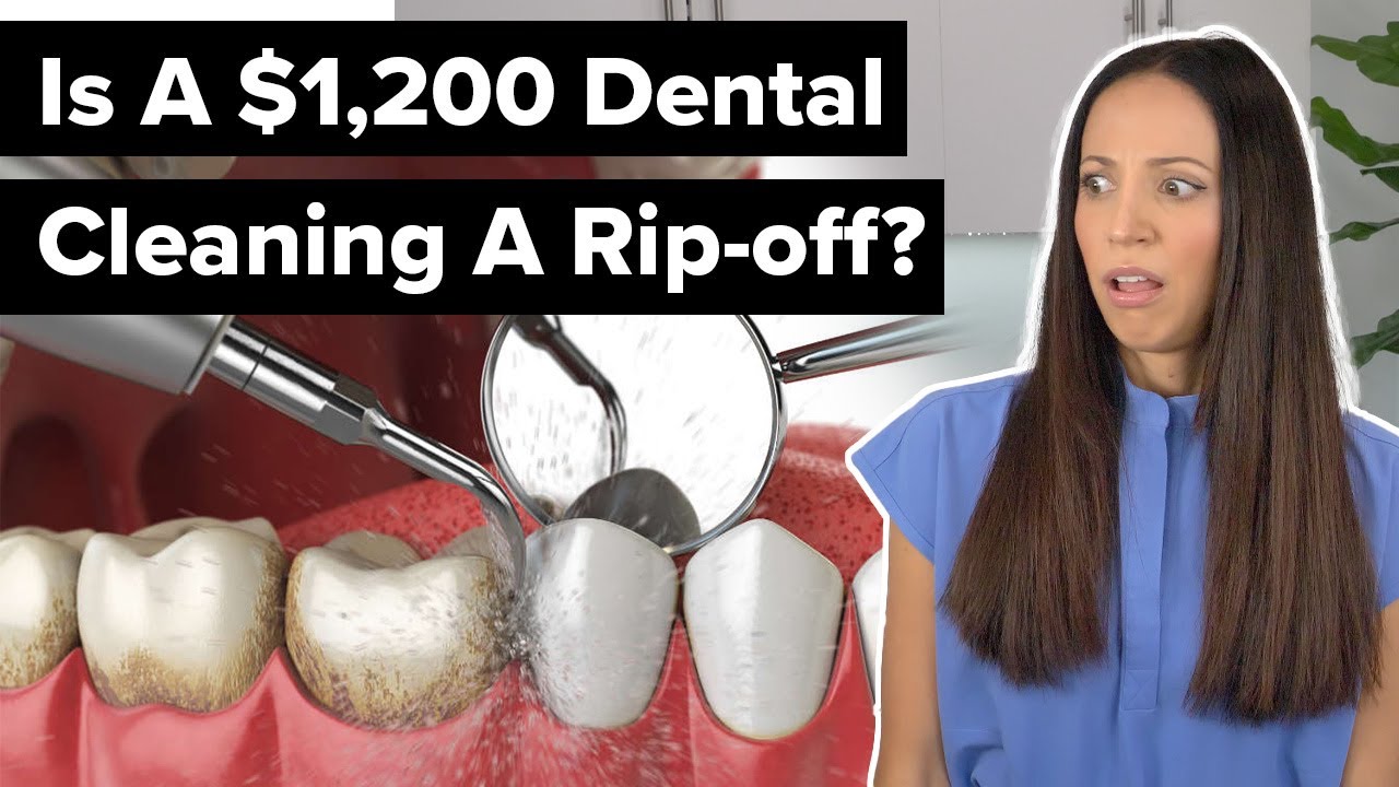 are DEEP CLEANINGS a SCAM!? (cost explained)