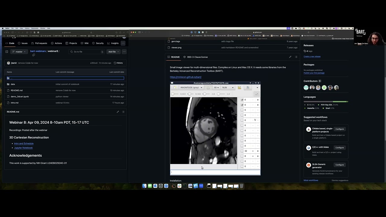 BART Webinar #8 - Deep dive into 3D Cartesian reconstruction with BART