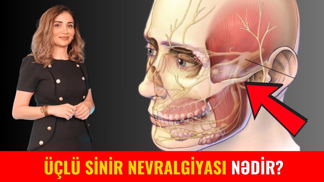 Üçlü sinir nevralgiyası nədir?