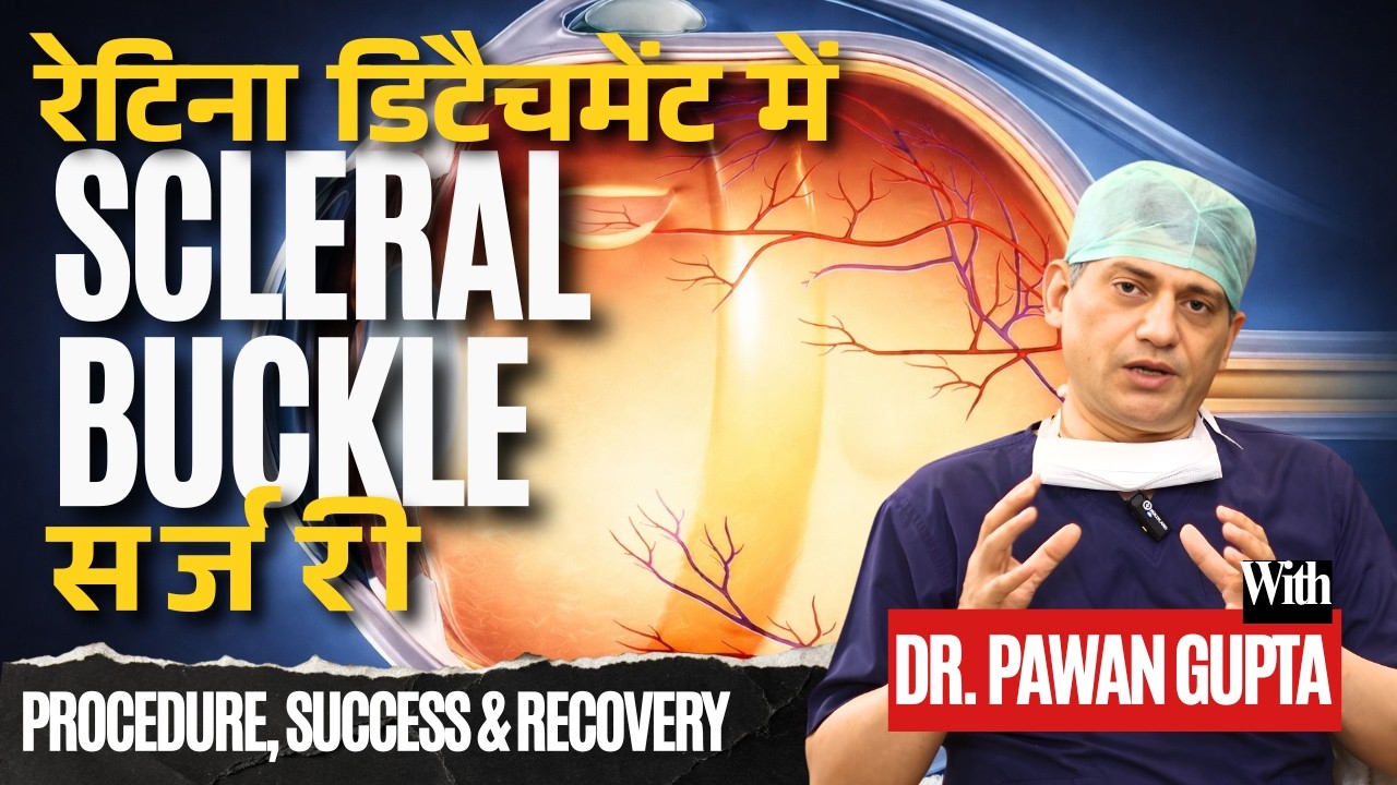 How Scleral Buckle Surgery Fixes a Detached Retina | Dr. Pawan Gupta