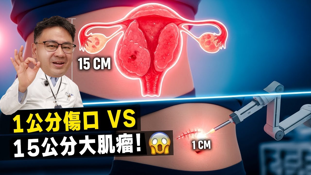 子宮肌瘤手術也能「完全無疤」？腹腔鏡、達文西手臂差在哪？醫師教你選對術式、保留生育力！∣ft. 何鎮宇醫師 新光醫院 婦產科