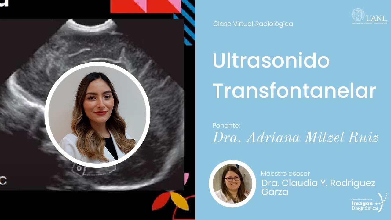 Ultrasonido Transfontanelar