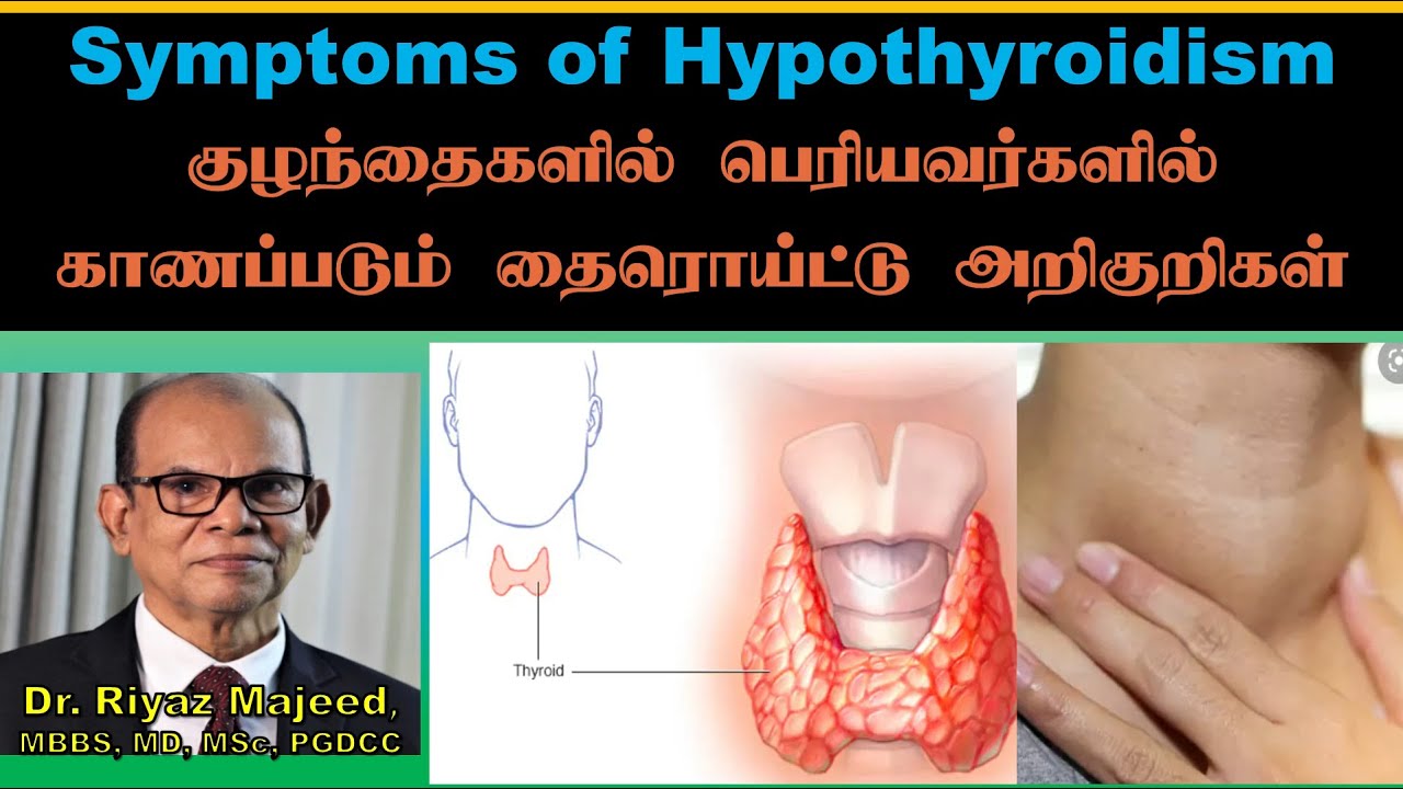 Symptoms of Hypothyroidism | Thyroid | குழந்தைகளில் பெரியவர்களில் காணப்படும் தைரொய்ட்டு அறிகுறிகள்