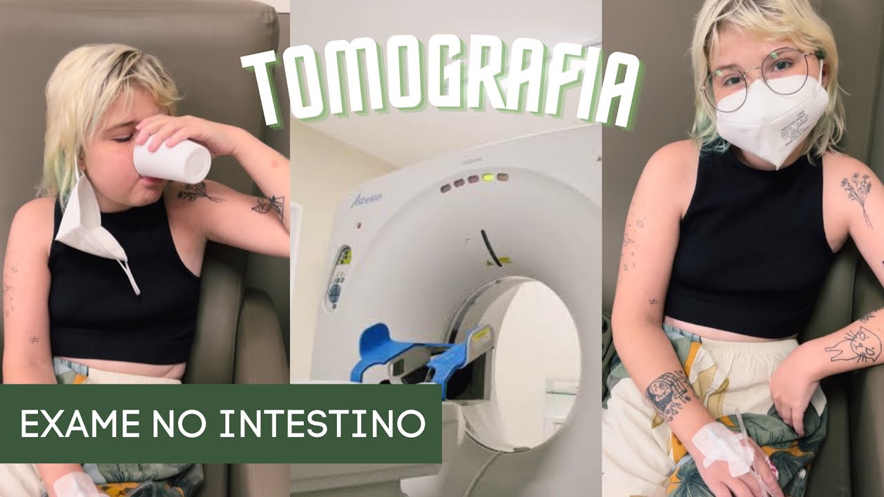 FAZENDO TOMOGRAFIA DE ABDOMEN - como é? explicando os contraste e preparo para doença de crohn