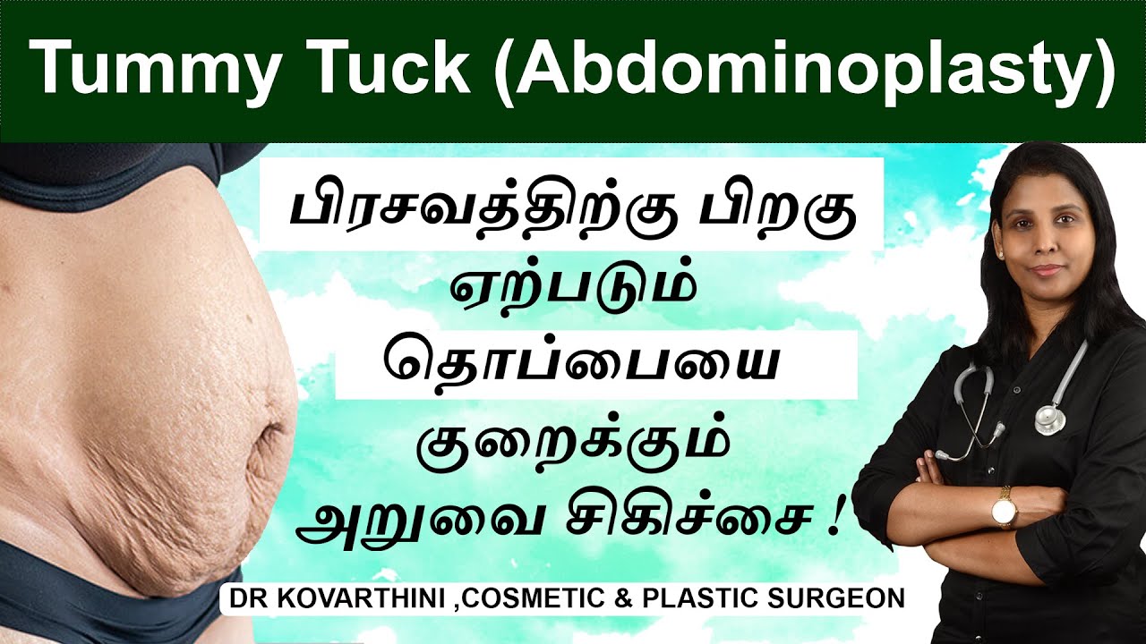 Abdominoplasty (Tummy Tuck) with Liposuction | Surgical procedures in Tamil-Dr.Kovarthini MS, MCh.,
