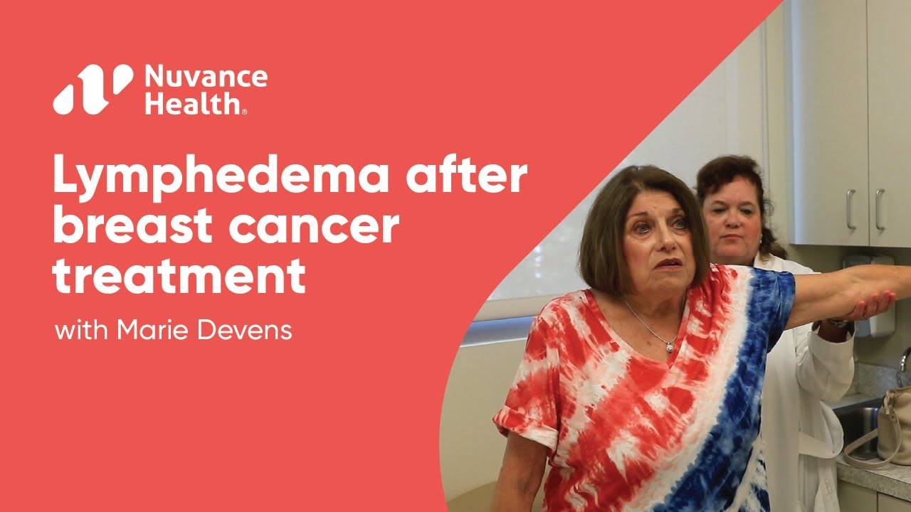 Lymphedema After Breast Cancer Treatment