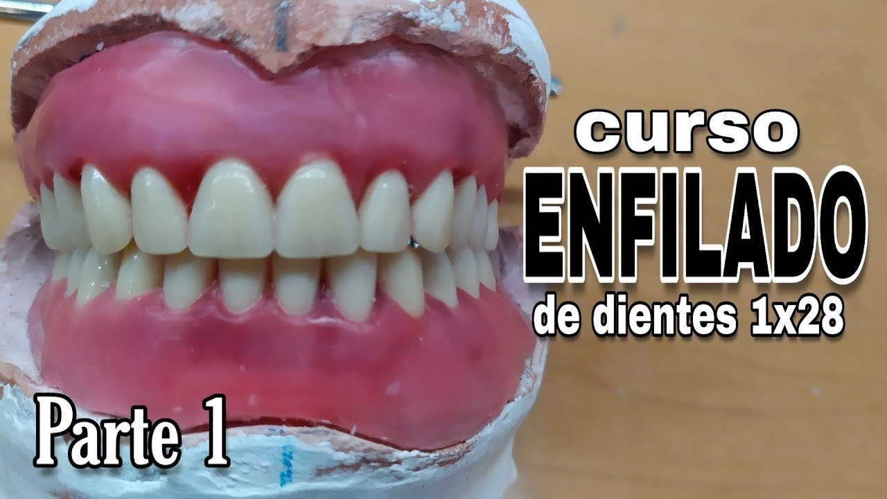 PRÓTESIS TOTAL ENFILADO o ARTICULADO DE DIENTES SUPERIORES : Parte 1