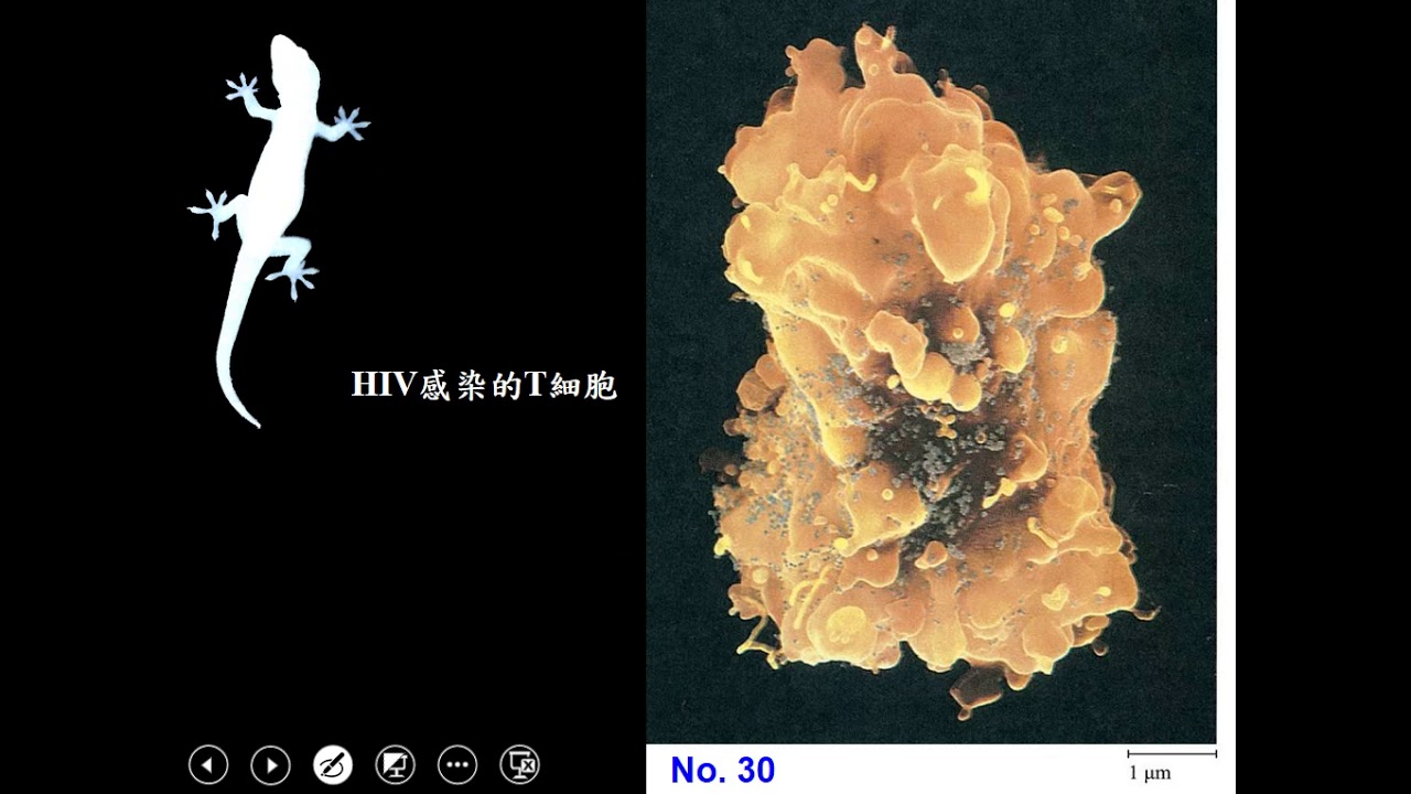 10802高三選修生物ch10 3 17免疫缺失 後天免疫缺失三書