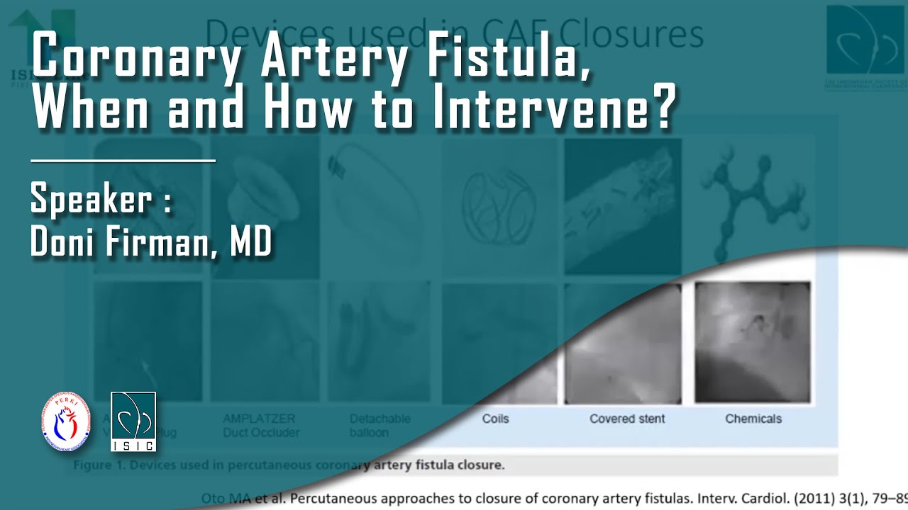 Coronary Artery Fistula - When and How to Intervene?