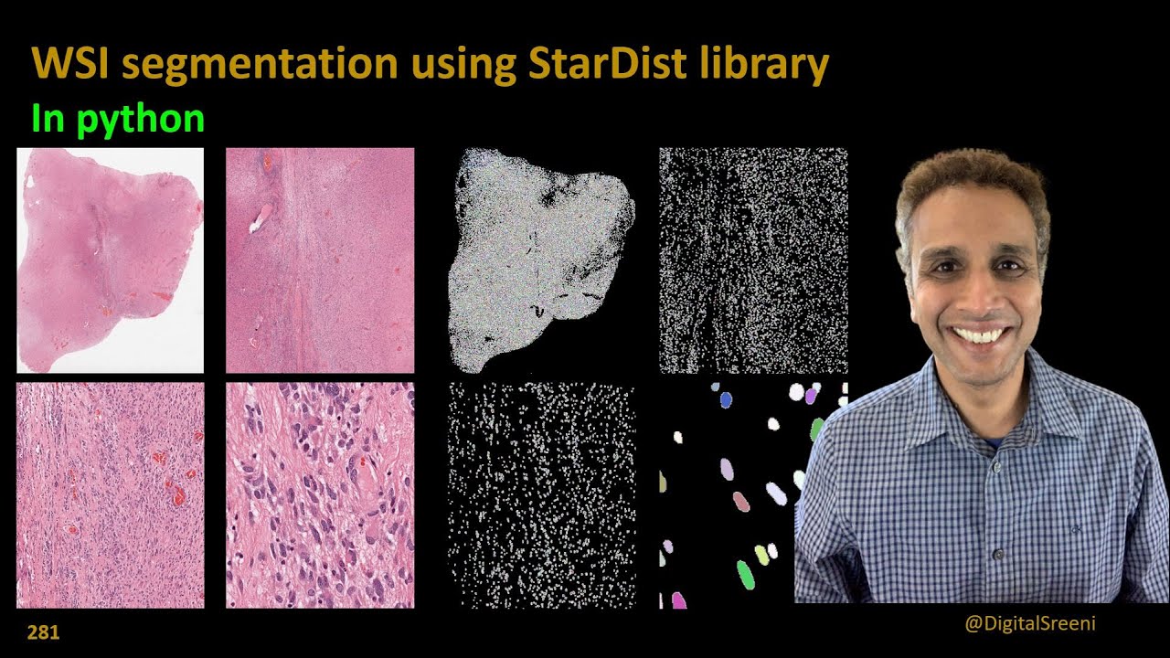 281 - Segmenting whole slide images (WSI) for nuclei using StarDist in python