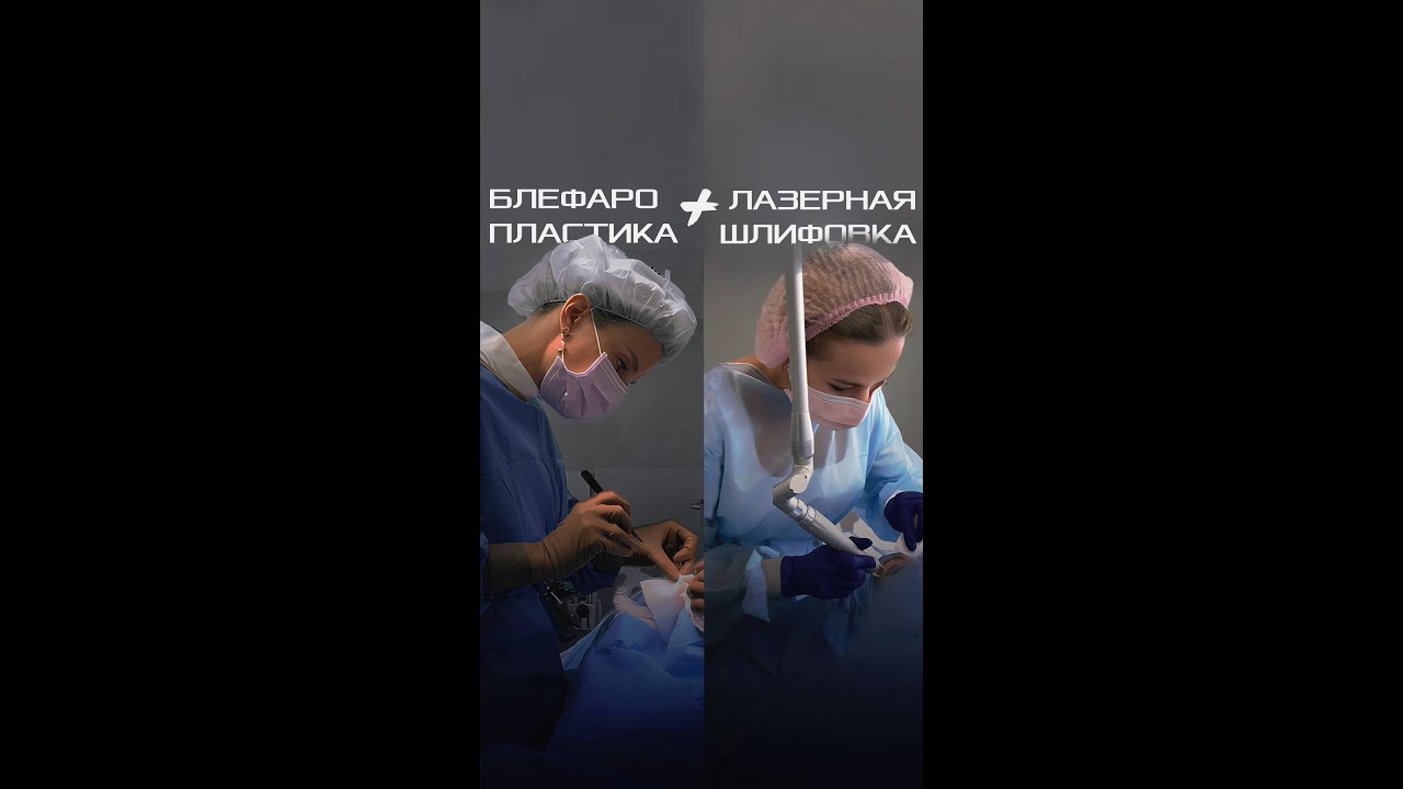 Блефаропластика + лазерная шлифовка под наркозом. Двойное омоложение. Кошельник О.А., Сиверина Е.А.