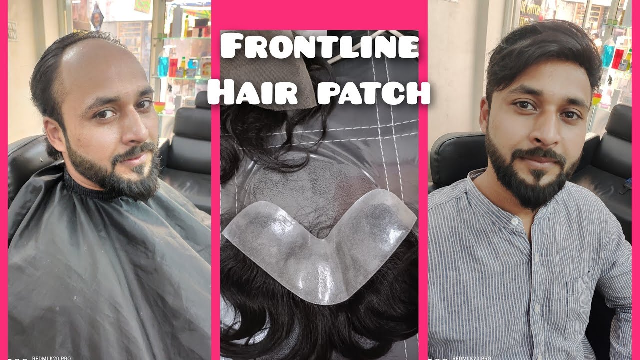 frontline hair patch Lakshmi Nagar metro station gate1 Delhi,9654640224₹,3999