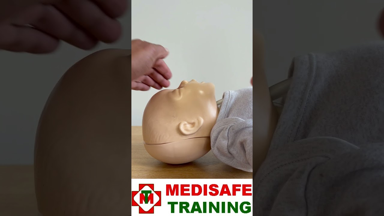 How to open an infant airway