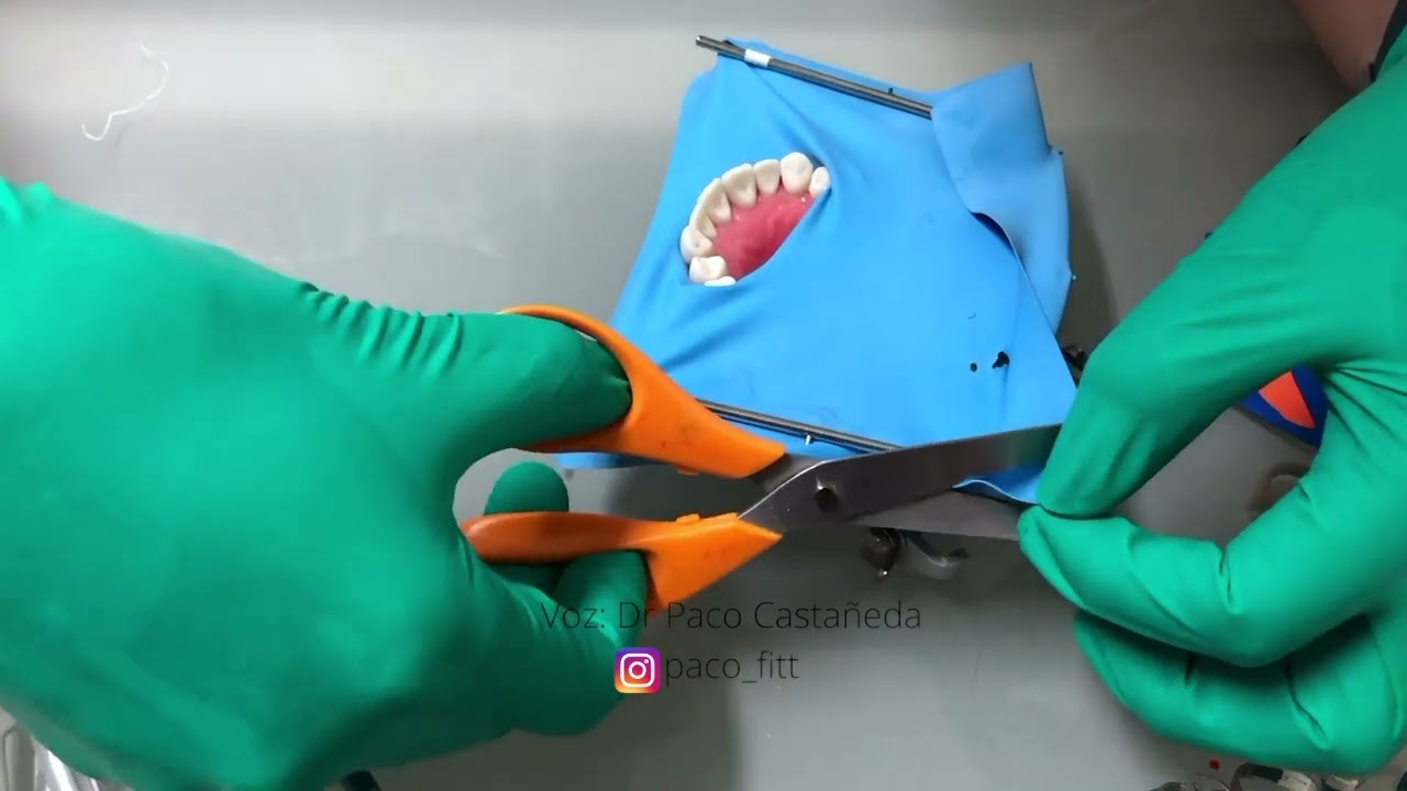 Técnica de Aislamiento Split Dam SIN grapas