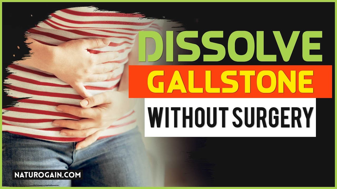 How to Break Large Gallbladder Stone, Pass Gallstone Without Surgery at Home