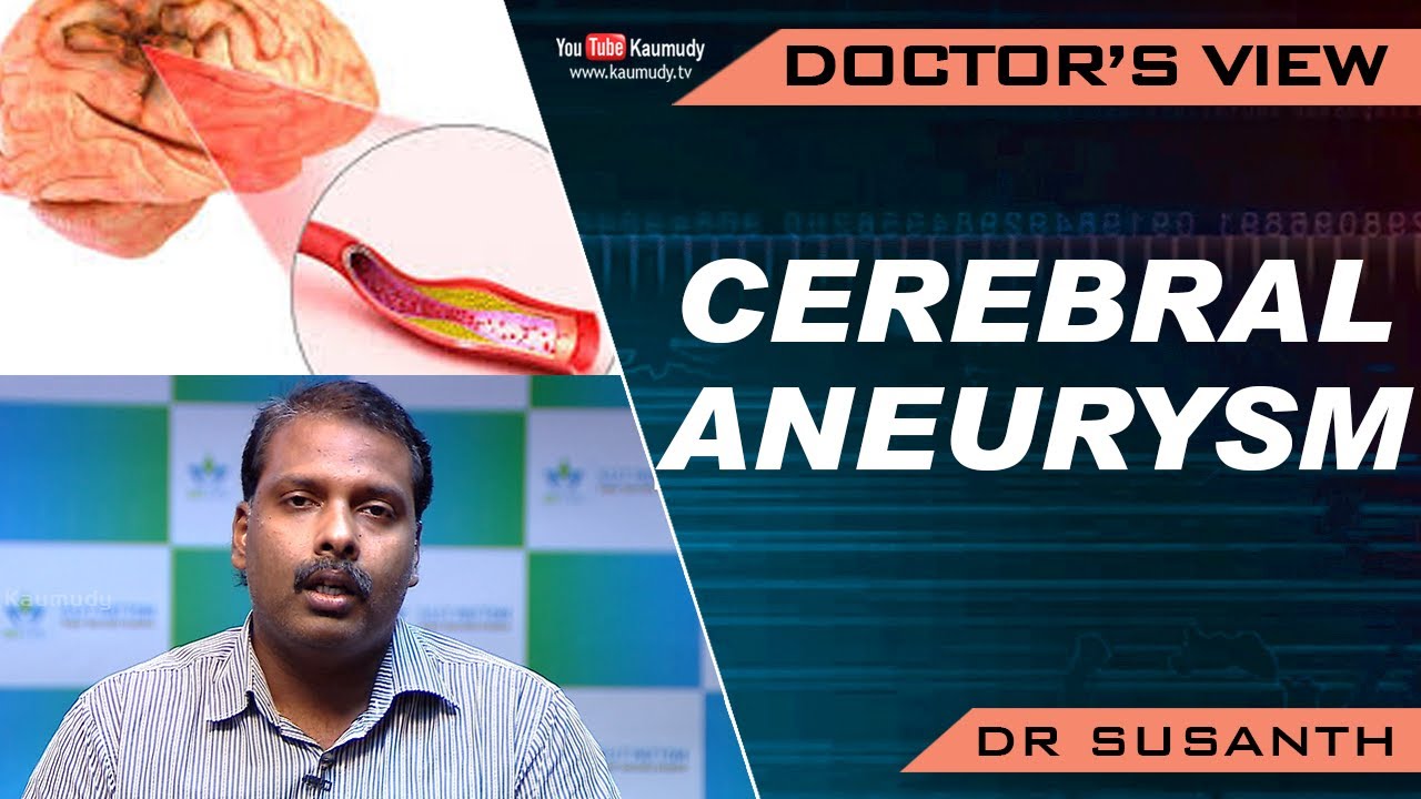 Cerebral Aneurysm | Dr Susanth | Health