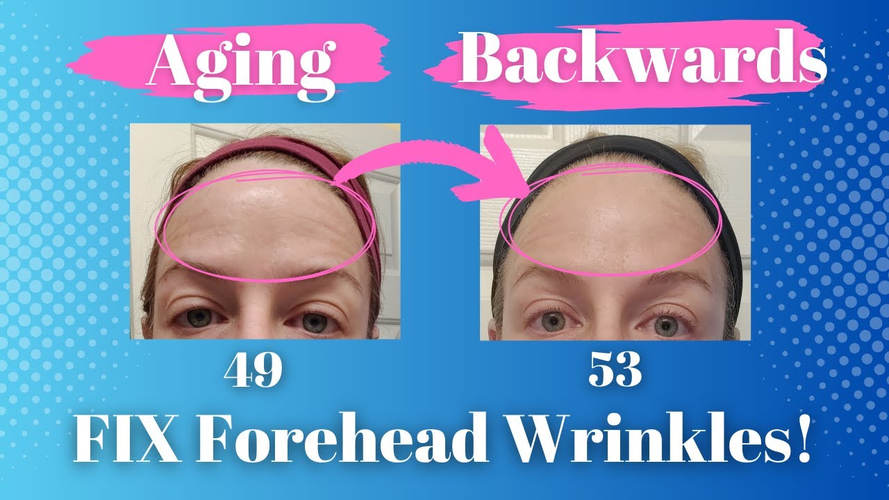 The BEST At-Home Treatment for Forehead Wrinkles!