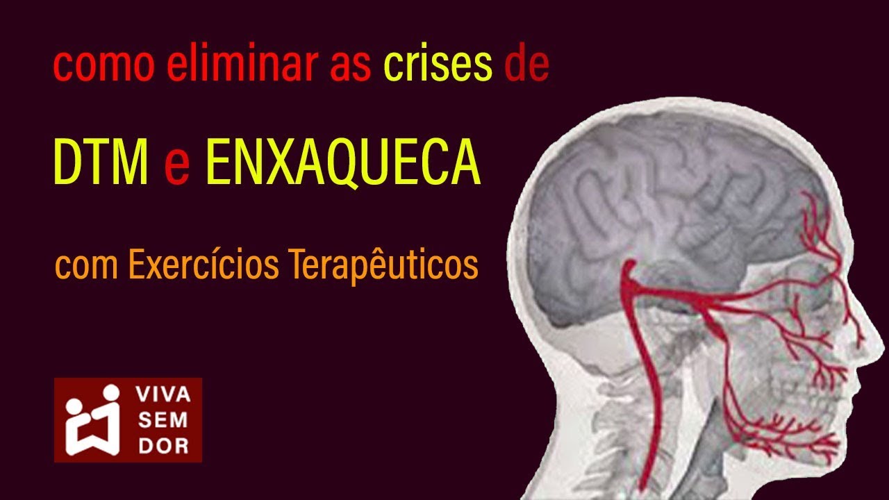 Como eliminar as crises de DTM e enxaqueca com exercícios terapêuticos