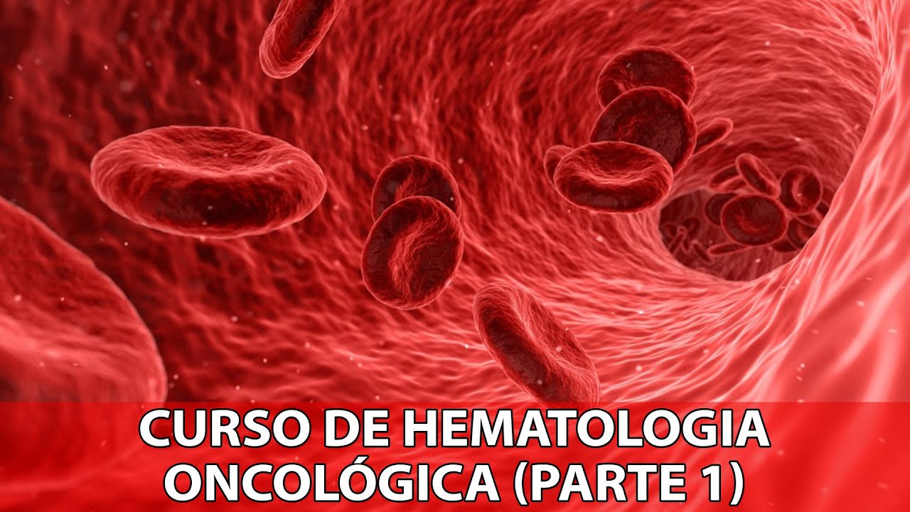 Curso de Hematologia Oncológica | Diagnóstico Laboratorial das Leucemias - P1 - IBAP Cursos