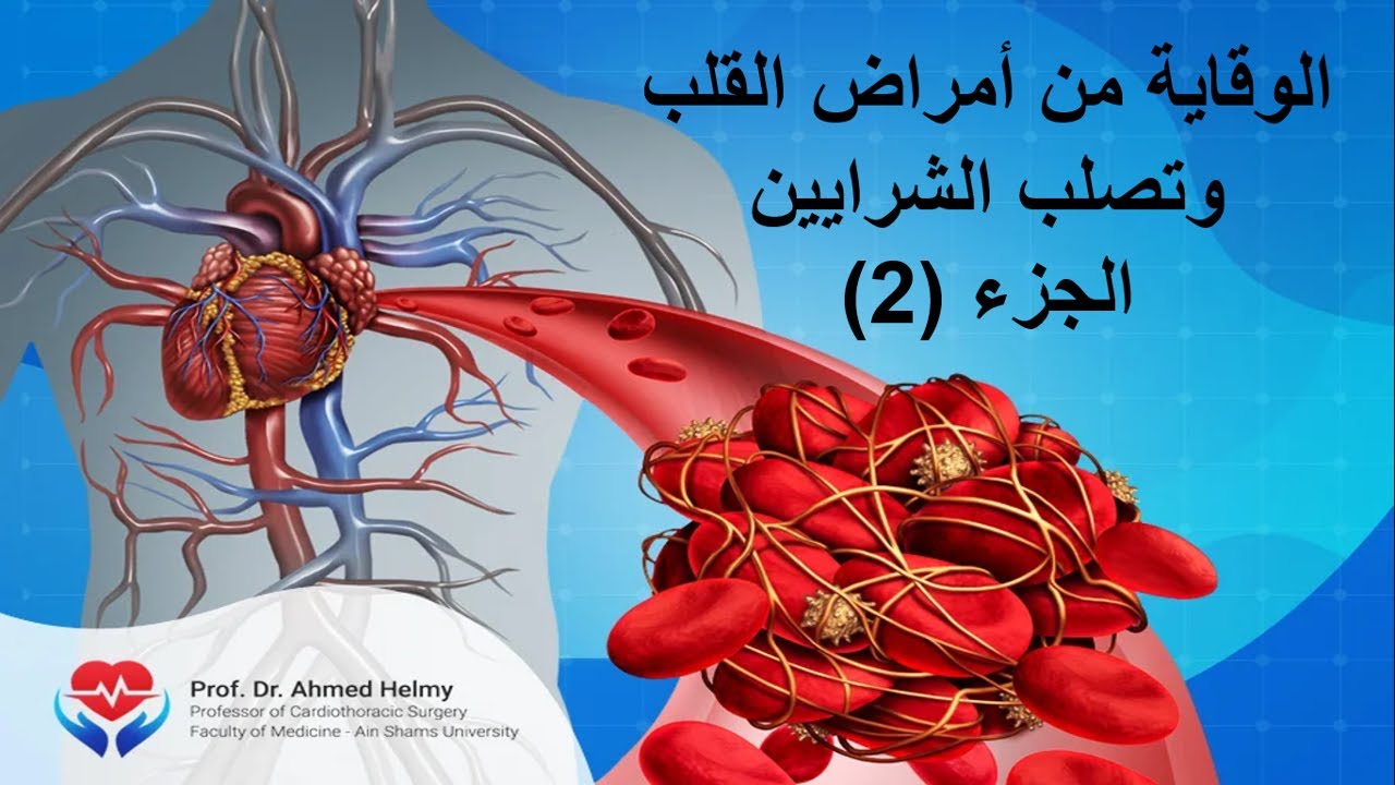 الوقاية من أمراض القلب وتصلب الشرايين 2 - أهمية الرياضة والفيتامينات للحفاظ على شرايين القلب
