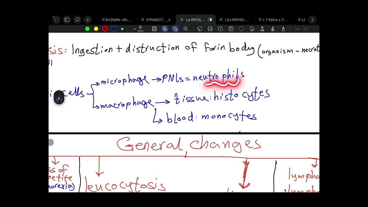 L6 pathology _acute inflammation