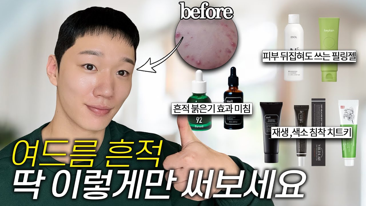 색소침착 레전드 조합 찾음😎 여드름 흔적이 고민일 때 