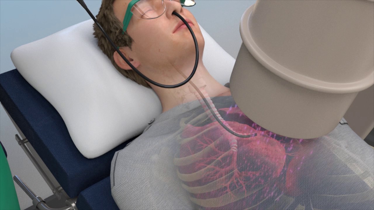 CHEST Foundation - Learn About Lung Biopsies